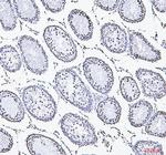 NRF1 Antibody in Immunohistochemistry (Paraffin) (IHC (P))