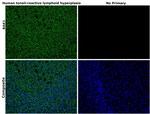 BAK1 Antibody in Immunohistochemistry (Paraffin) (IHC (P))