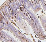 BAK1 Antibody in Immunohistochemistry (Paraffin) (IHC (P))