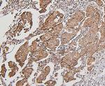 BAK1 Antibody in Immunohistochemistry (Paraffin) (IHC (P))