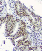 RPA70 Antibody in Immunohistochemistry (Paraffin) (IHC (P))