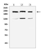 Collagen IV Antibody in Western Blot (WB)