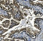 GAA Antibody in Immunohistochemistry (Paraffin) (IHC (P))