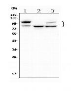 GAA Antibody in Western Blot (WB)