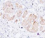 PDCD6IP Antibody in Immunohistochemistry (Paraffin) (IHC (P))