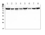 PDCD6IP Antibody in Western Blot (WB)