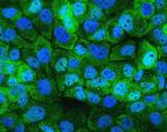 HSPH1 Antibody in Immunocytochemistry (ICC/IF)