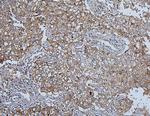 HSPH1 Antibody in Immunohistochemistry (Paraffin) (IHC (P))