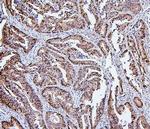 HSPH1 Antibody in Immunohistochemistry (Paraffin) (IHC (P))