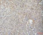 CFL2 Antibody in Immunohistochemistry (Paraffin) (IHC (P))