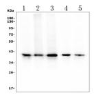 RP2 Antibody in Western Blot (WB)