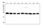 RAB11B Antibody in Western Blot (WB)