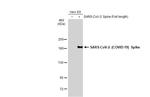 SARS-CoV-2 Spike Protein S1 Antibody in Western Blot (WB)