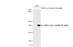 SARS-CoV-2 Spike Protein S1 Antibody in Western Blot (WB)