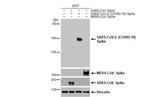 SARS-CoV-2 Spike Protein S1 Antibody in Western Blot (WB)