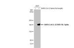 SARS-CoV-2 Spike Protein S1 Antibody in Western Blot (WB)