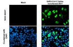 SARS-CoV-2 Spike Protein S1 Antibody in Immunocytochemistry (ICC/IF)