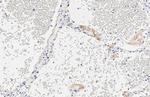 SARS-CoV-2 Spike Protein S1 Antibody in Immunohistochemistry (Paraffin) (IHC (P))