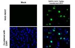 SARS-CoV-2 Spike Protein S1 Antibody in Immunocytochemistry (ICC/IF)