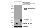 SARS-CoV-2 Spike Protein S1 Antibody in Western Blot (WB)