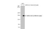 SARS-CoV-2 Spike Protein S1 Antibody in Western Blot (WB)