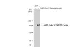 SARS-CoV-2 Spike Protein S1 Antibody in Western Blot (WB)