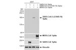 SARS-CoV-2 Spike Protein S1 Antibody in Western Blot (WB)