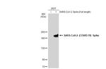 SARS-CoV-2 Spike Protein S1 Antibody in Western Blot (WB)