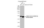 SARS-CoV-2 Nucleocapsid Antibody in Western Blot (WB)