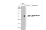 SARS-CoV-2 Nucleocapsid Antibody in Western Blot (WB)