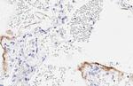 SARS-CoV-2 Nucleocapsid Antibody in Immunohistochemistry (Paraffin) (IHC (P))