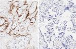 SARS-CoV-2 Nucleocapsid Antibody in Immunohistochemistry (Paraffin) (IHC (P))