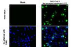 SARS-CoV-2 Nucleocapsid Antibody in Immunocytochemistry (ICC/IF)