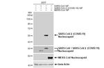 SARS-CoV-2 Nucleocapsid Antibody in Western Blot (WB)