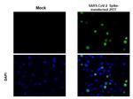 SARS-CoV-2 Spike Protein (RBD) Antibody in Immunohistochemistry (Paraffin) (IHC (P))