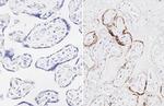 SARS-CoV-2 Spike Protein (RBD) Antibody in Immunohistochemistry (Paraffin) (IHC (P))