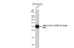 SARS-CoV-2 Spike Protein (RBD) Antibody in Western Blot (WB)