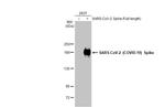 SARS-CoV-2 Spike Protein (RBD) Antibody in Western Blot (WB)