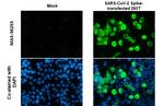 SARS-CoV-2 Spike Protein (RBD) Antibody in Immunocytochemistry (ICC/IF)