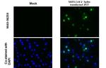SARS-CoV-2 Spike Protein (RBD) Antibody in Immunocytochemistry (ICC/IF)