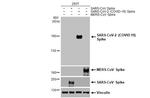 SARS-CoV-2 Spike Protein (RBD) Antibody in Western Blot (WB)