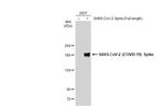 SARS-CoV-2 Spike Protein (RBD) Antibody in Western Blot (WB)