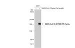 SARS-CoV-2 Spike Protein S2 Antibody in Western Blot (WB)