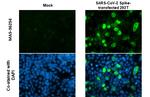 SARS-CoV-2 Spike Protein S2 Antibody in Immunocytochemistry (ICC/IF)