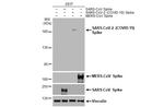 SARS-CoV-2 Spike Protein S2 Antibody in Western Blot (WB)