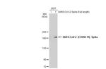 SARS-CoV-2 Spike Protein S2 Antibody in Western Blot (WB)