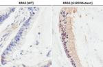 Ras (G12D Mutant) Antibody in Immunohistochemistry (Paraffin) (IHC (P))