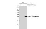 Ras (G12D Mutant) Antibody in Western Blot (WB)