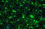 IBA1 Antibody in Immunohistochemistry (Paraffin) (IHC (P))