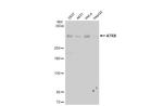 ATRX Antibody in Western Blot (WB)